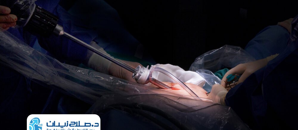 تكلفة عملية استئصال البروستاتا