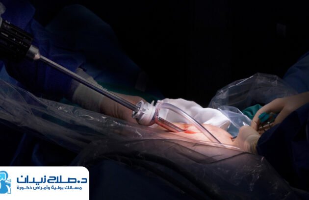 تكلفة عملية استئصال البروستاتا