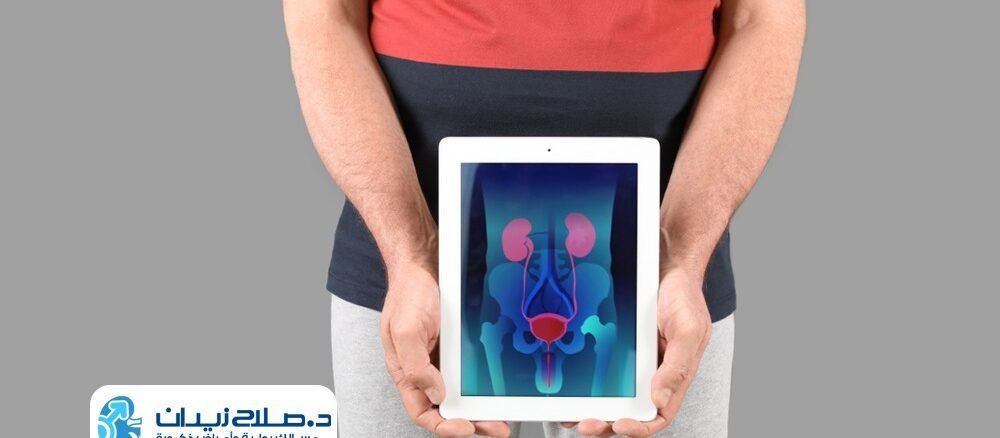 تكلفة عملية البروستاتا بالتبخير