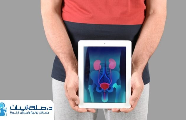 تكلفة عملية البروستاتا بالتبخير