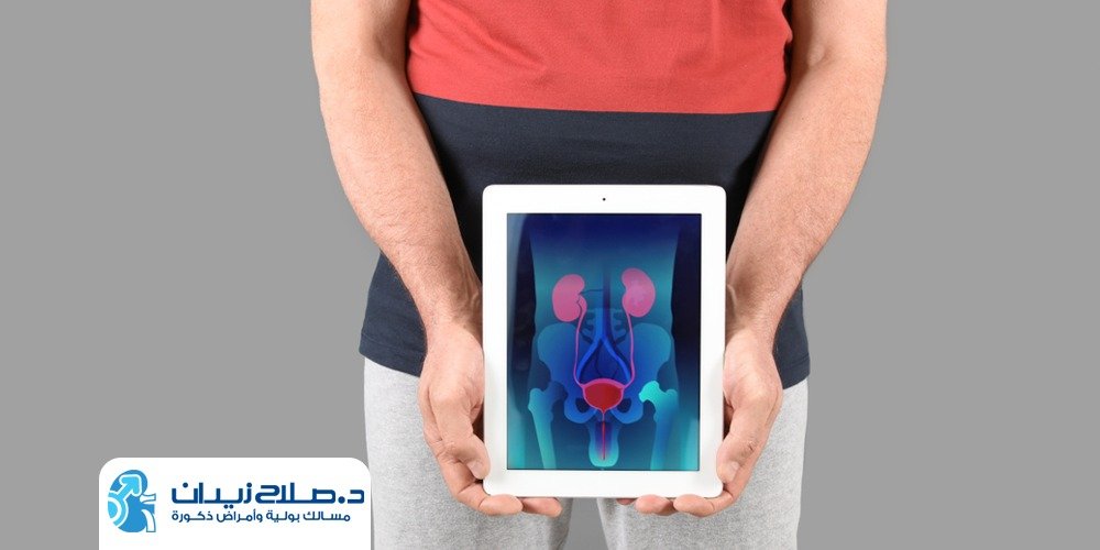 تكلفة عملية البروستاتا بالتبخير