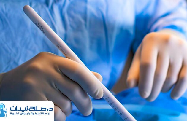 تكلفة عملية دعامة الانتصاب