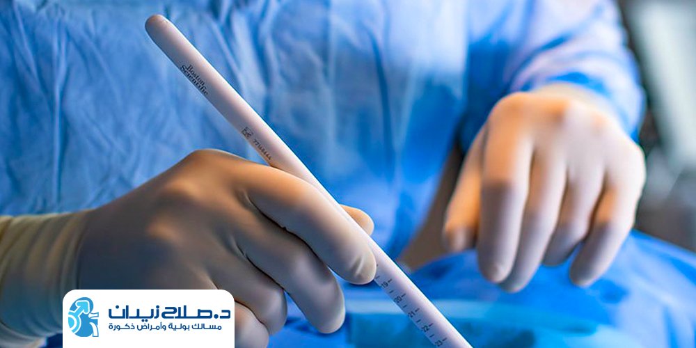 تكلفة عملية دعامة الانتصاب