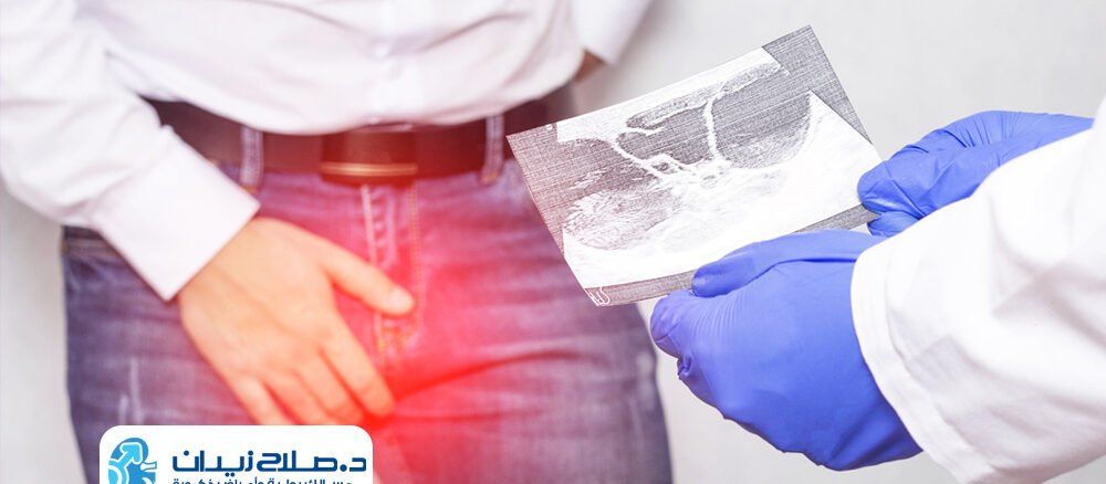 سعر عملية دوالي الخصية