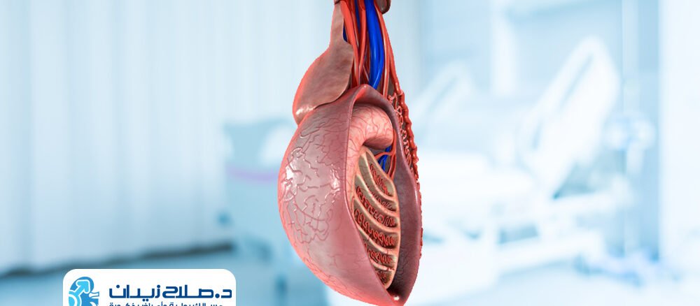 علاج دوالي الخصيتين