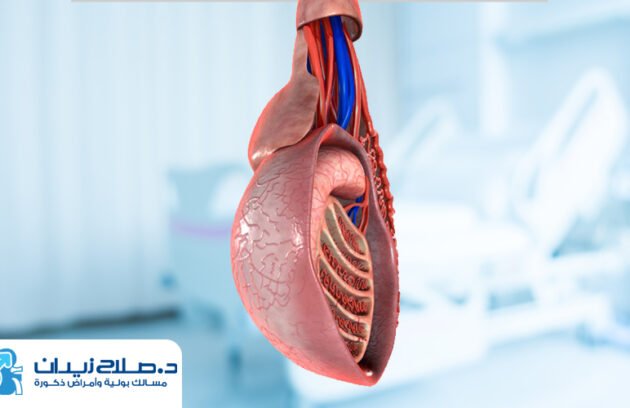 علاج دوالي الخصيتين