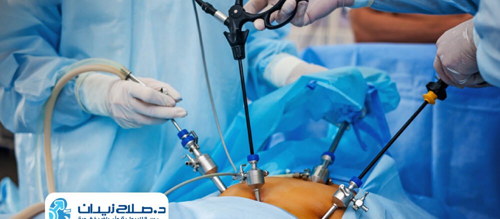 عملية البروستاتا بالمنظار