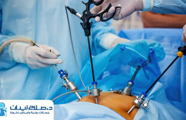 عملية البروستاتا بالمنظار