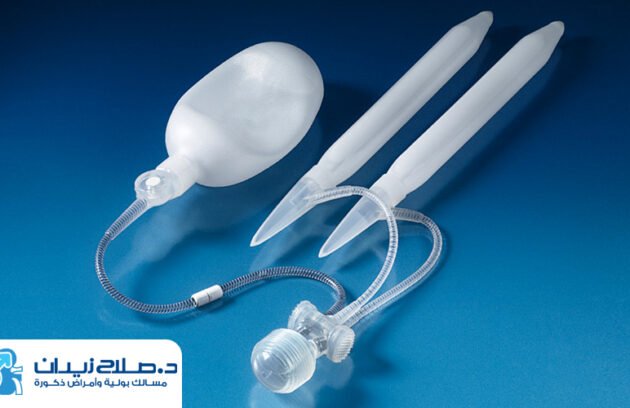 عملية تركيب الدعامة للعضو الذكري