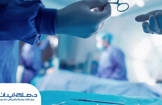 الأثار الجانبية بعد عملية استئصال البروستاتا