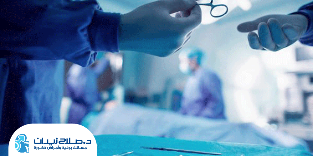 الأثار الجانبية بعد عملية استئصال البروستاتا