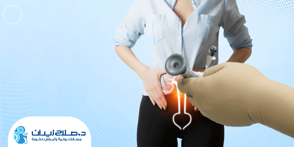 تجربتي مع منظار المثانة