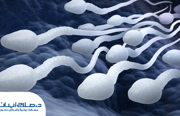 التفتيش الميكروسكوبي لعلاج صفر الحيونات المنويه