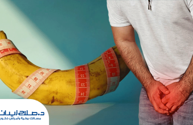 تجربتي مع مرض بيروني