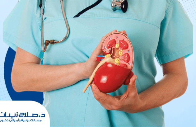 نصائح-للتخلص-من-حصوات-الكلى