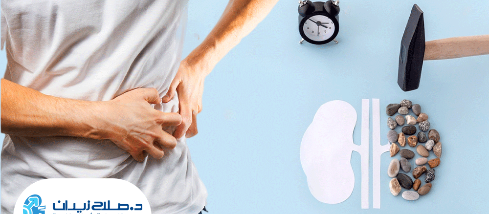 علامات-نزول-حصوة-الكلى