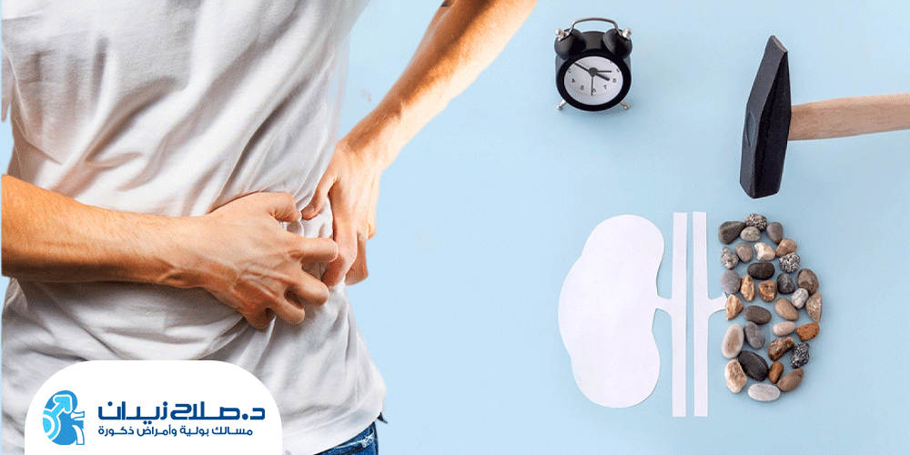 علامات-نزول-حصوة-الكلى