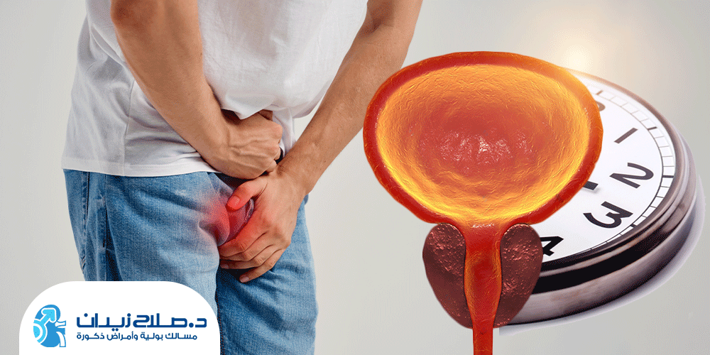 مدة-الشفاء-بعد-عملية-البروستات