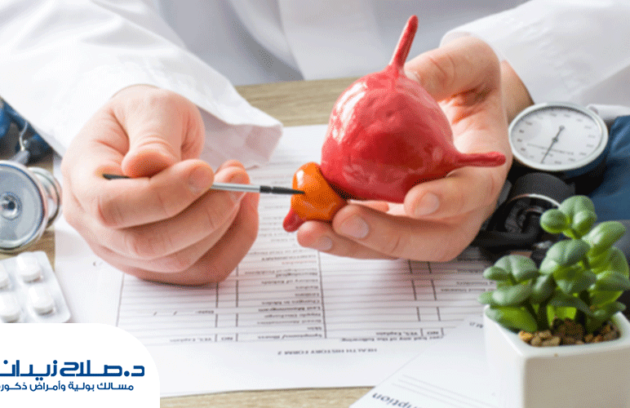 نصائح-بعد-استئصال-البروستاتا