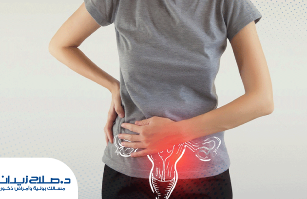 هل-يمكن-ان-يكون-ورم-المثانة-حميد؟