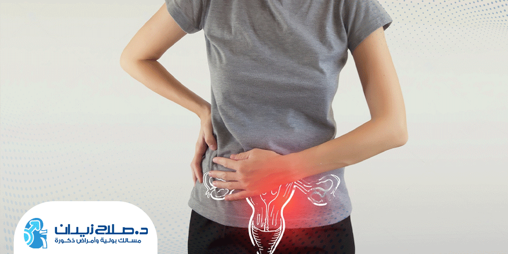 هل-يمكن-ان-يكون-ورم-المثانة-حميد؟