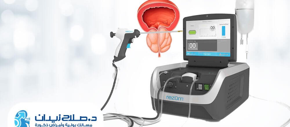 تقنية الرزيوم في مصر