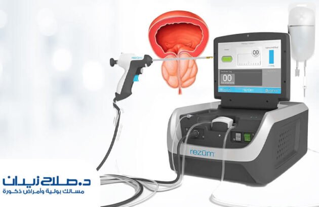 تقنية الرزيوم في مصر