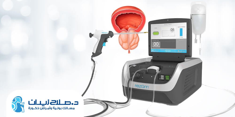 تقنية الرزيوم في مصر