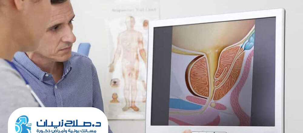 علاج البروستاتا بالرزيوم في مصر