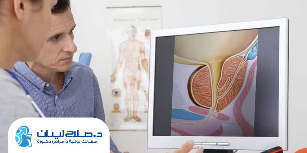 علاج البروستاتا بالرزيوم في مصر