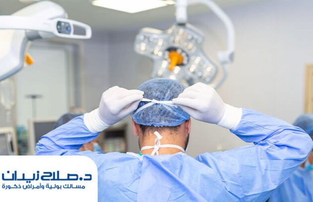 نسبة نجاح عملية دوالي الخصية