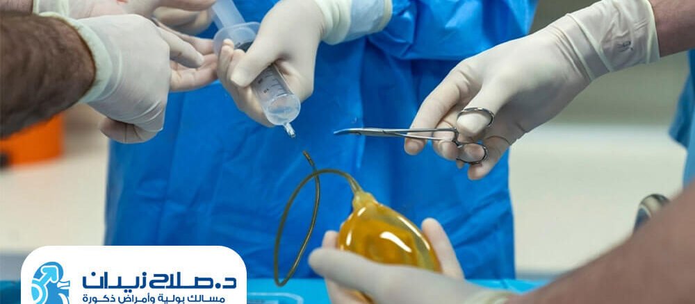 نصائح بعد عملية زرع دعامة العضو الذكري