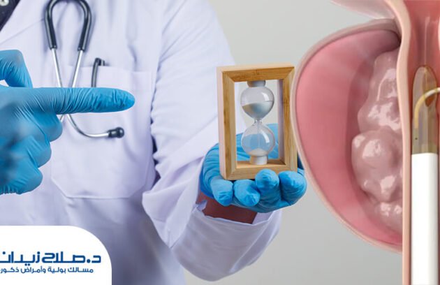 كم تستغرق عملية تبخير البروستاتا