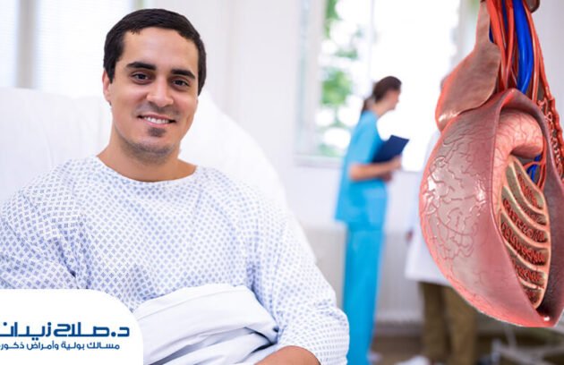 نصائح بعد عملية دوالي الخصية بالميكروسكوب