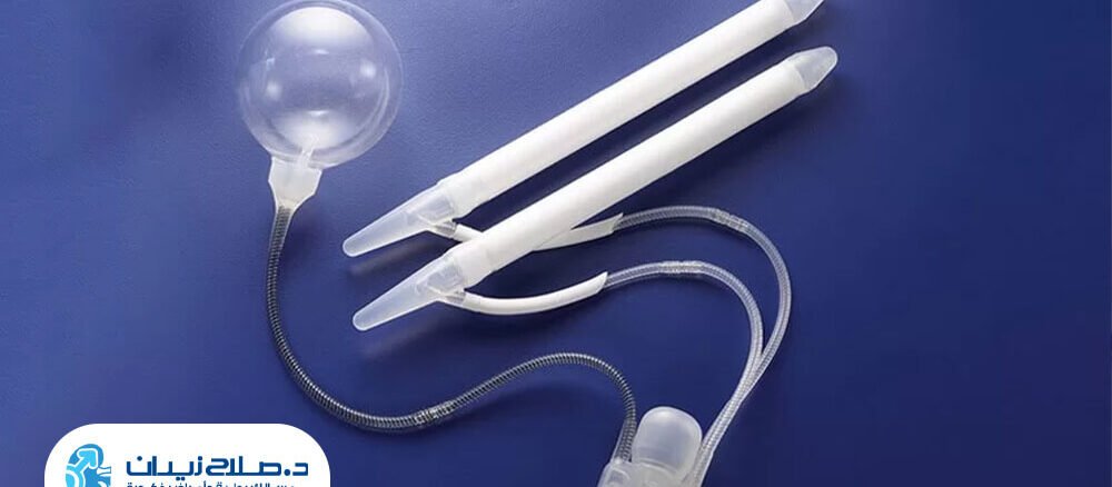 الدعامة المرنة المميزات والعيوب