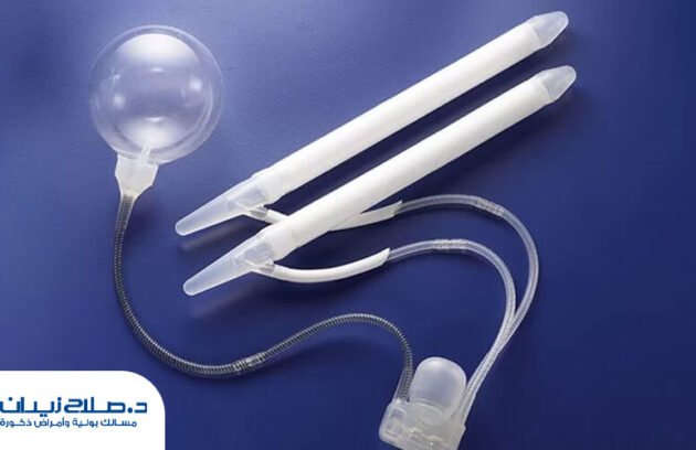 الدعامة المرنة المميزات والعيوب