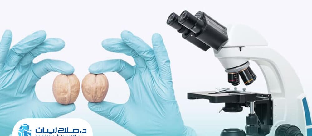 عملية دوالي الخصية بالميكروسكوب