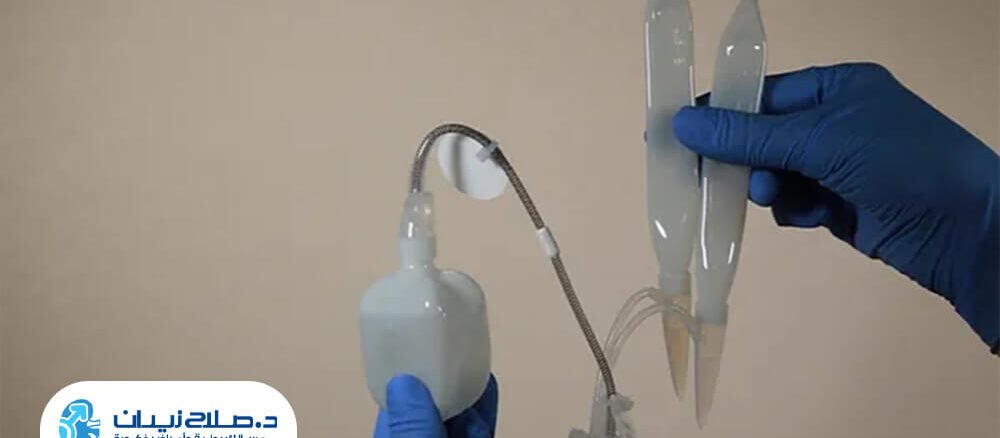 ما هي أنواع الدعامات الذكرية