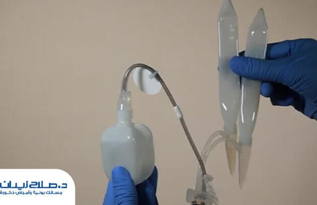 ما هي أنواع الدعامات الذكرية