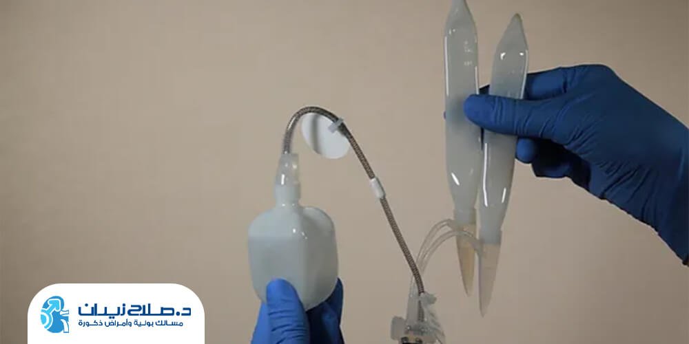 ما هي أنواع الدعامات الذكرية