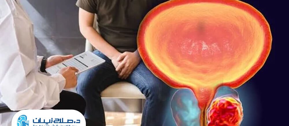 هل سرطان البروستاتا خطير؟