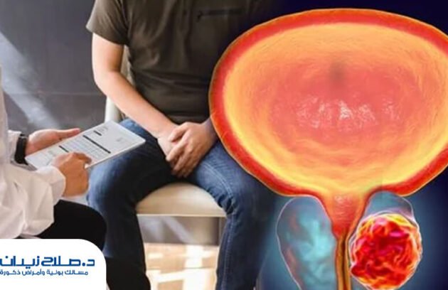 هل سرطان البروستاتا خطير؟