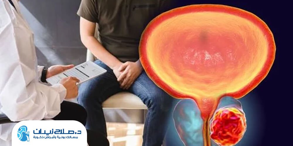 هل سرطان البروستاتا خطير؟