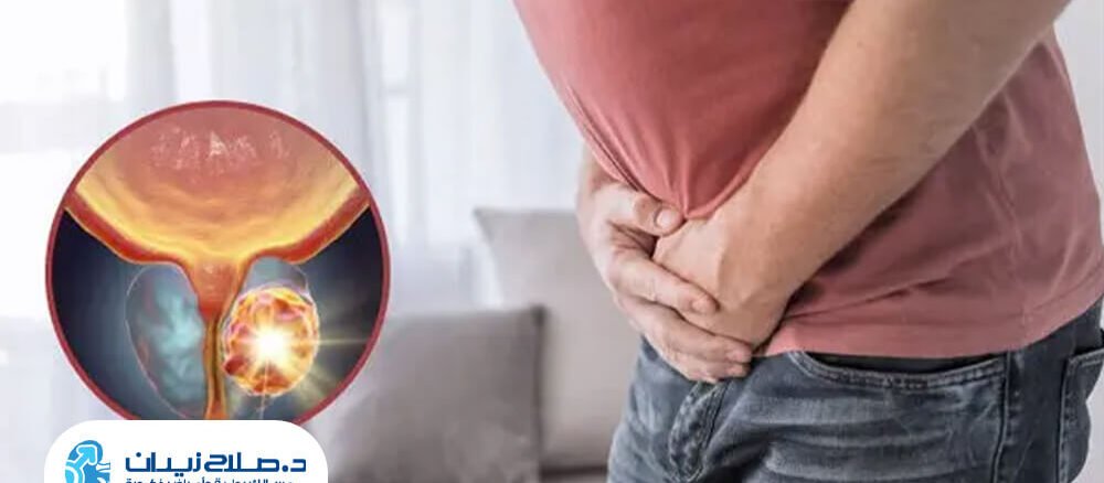 هل يتحول تضخم البروستاتا الحميد إلى ورم خبيث؟