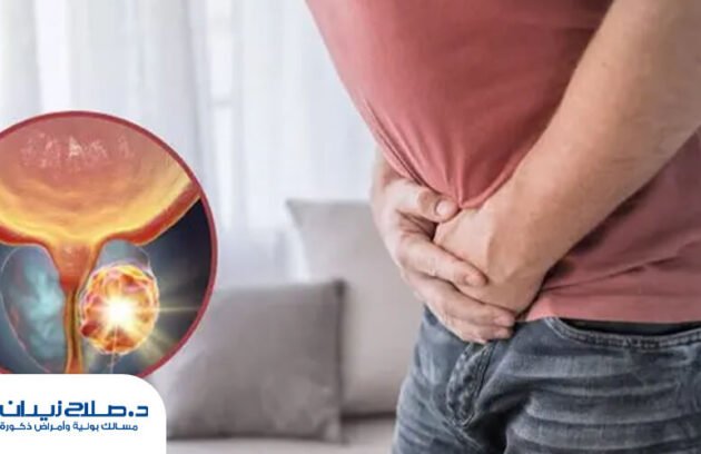 هل يتحول تضخم البروستاتا الحميد إلى ورم خبيث؟