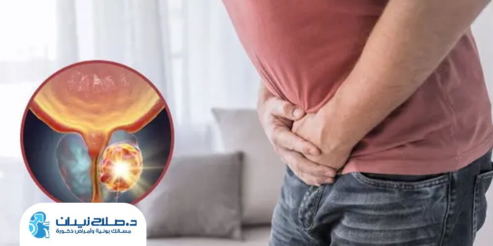 هل يتحول تضخم البروستاتا الحميد إلى ورم خبيث؟