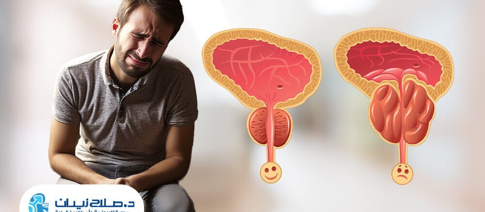 هل يعود تضخم البروستاتا بعد استئصالها؟