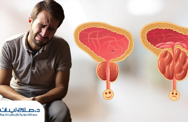 هل يعود تضخم البروستاتا بعد استئصالها؟