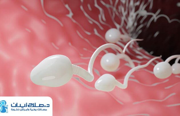 تغير لون السائل المنوي